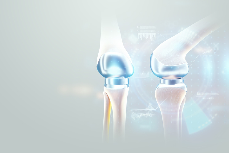 Hip and knee replacement surgery