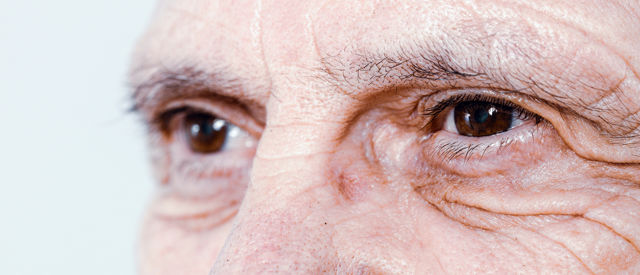 Problemas oculares comunes relacionados con la edad
