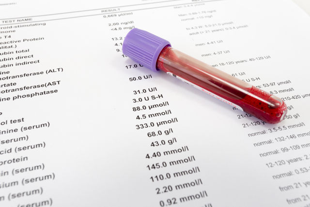 Types of Blood Tests