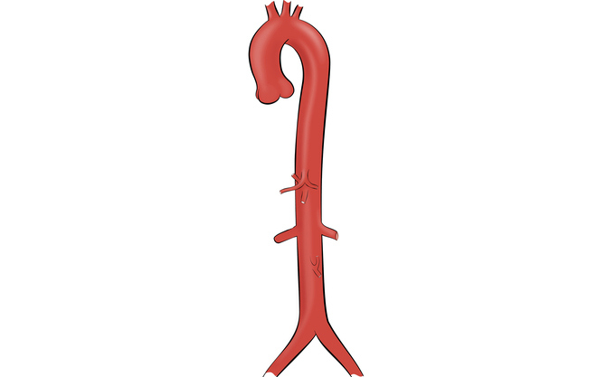 Anatomy of the Aorta