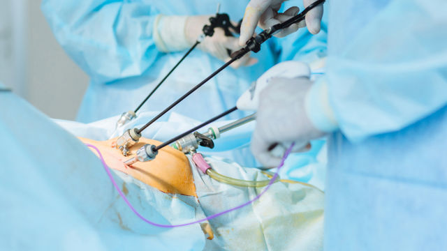 Procedimiento de cirugía colorrectal laparoscópica