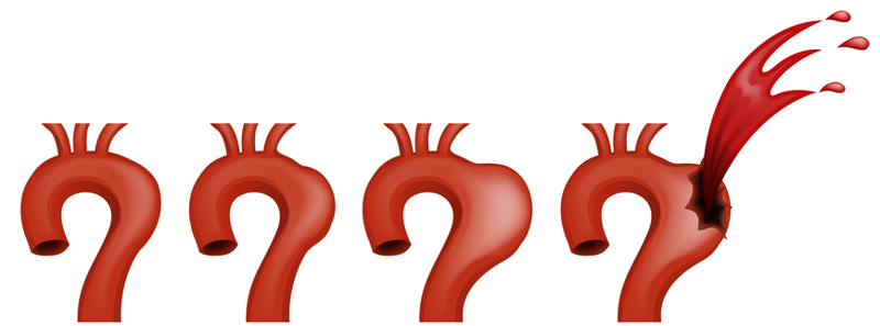 Thoracic aortic aneurysm causes