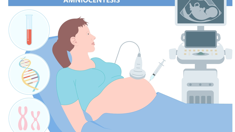 Anencephaly Causes Symptoms Diagnosis And Management   4 5cd2920c 78a4 4d65 9b06 Fc2f14aadde1 