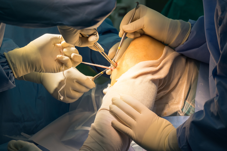 Joint Reconstruction Surgery