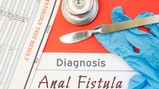 Diagnóstico de fístula anal
