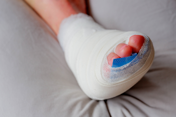 Minimally Invasive Foot Surgery