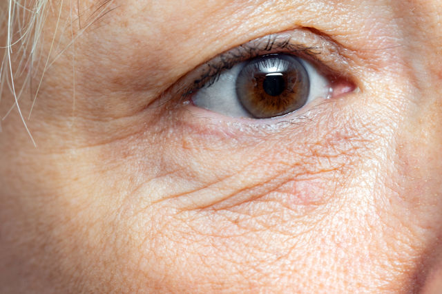 Gotas oftálmicas Similasan Aging Eye Relief 