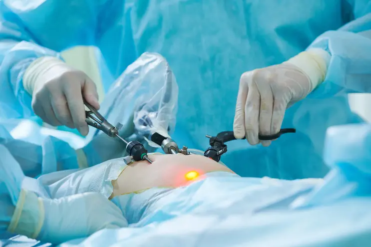 Gynecological laparoscopy procedure