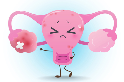 Ovarian Dysfunction