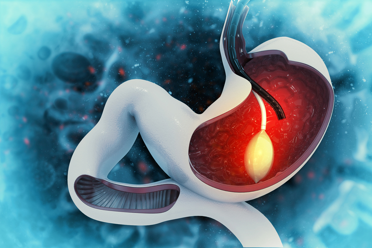 Pediatric Gastrointestinal Disease