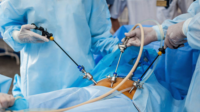 Procédure de prostatectomie laparoscopique