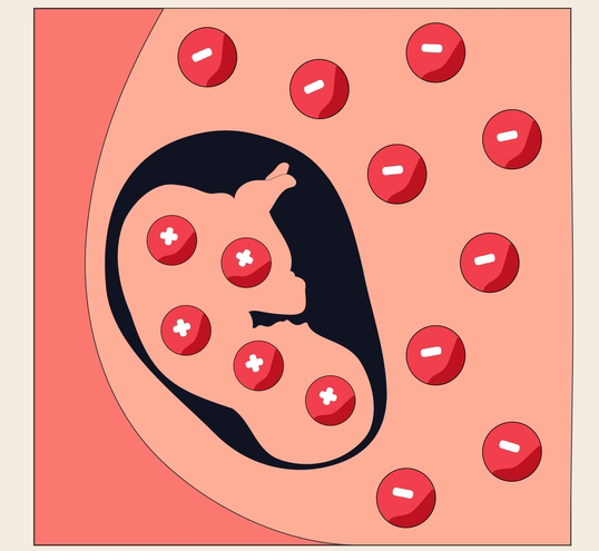 anemia-in-newborns