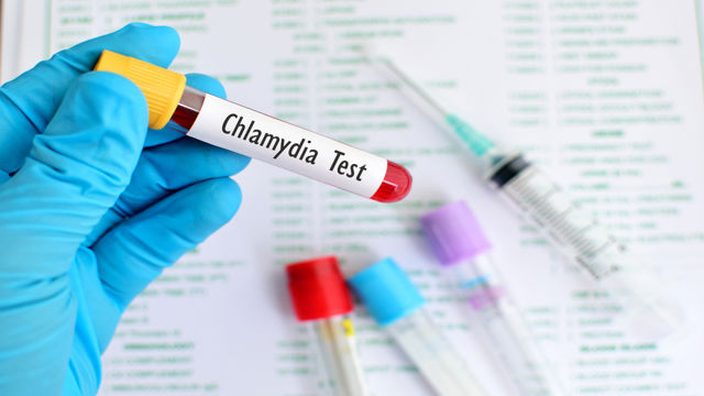 What You Need To Know About Chlamydia 3747
