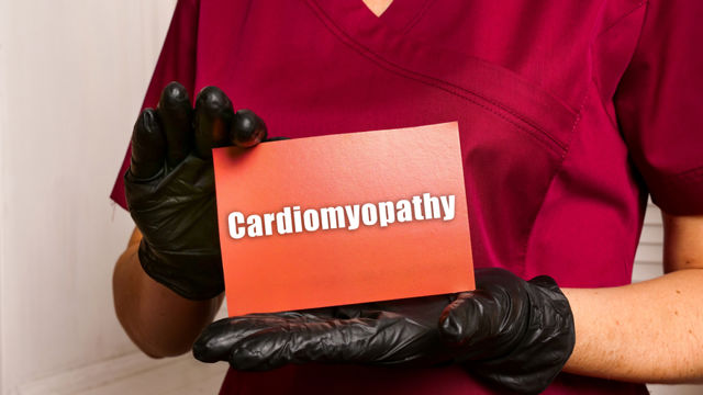 Cardiomiopatia periparto