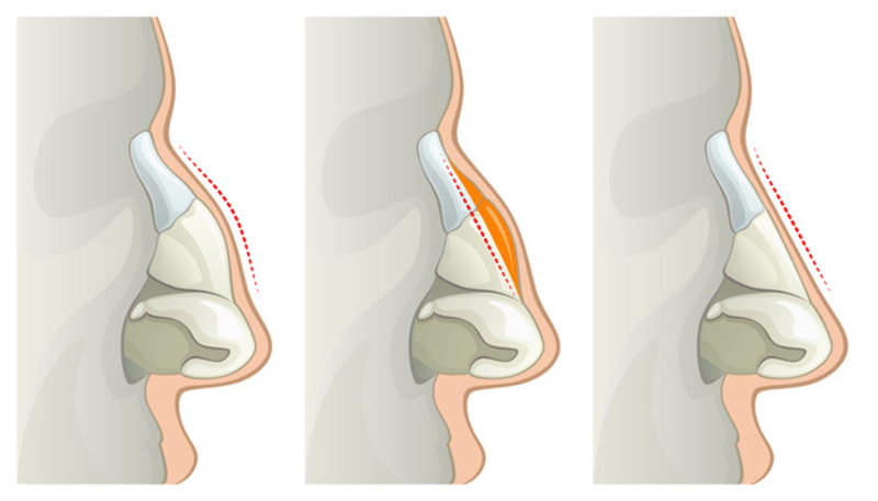 Common surgical deformities