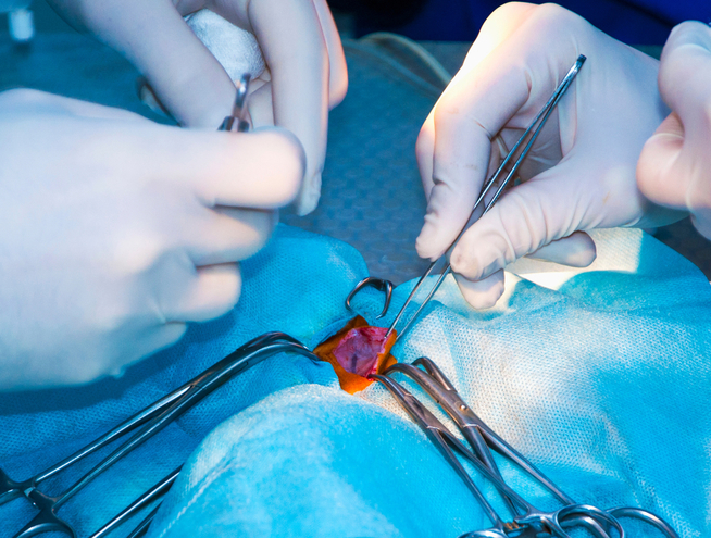 quy trình phẫu thuật động mạch cảnh
