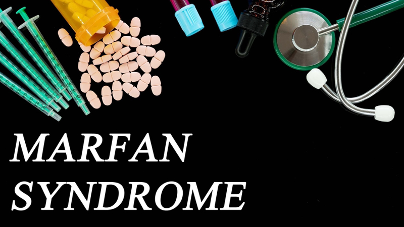 Marfan Syndrome: Clinical Diagnosis And Management