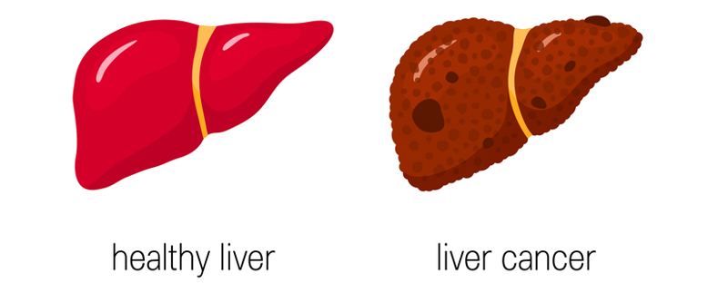 Hepato-Pancreato-Biliary Surgery