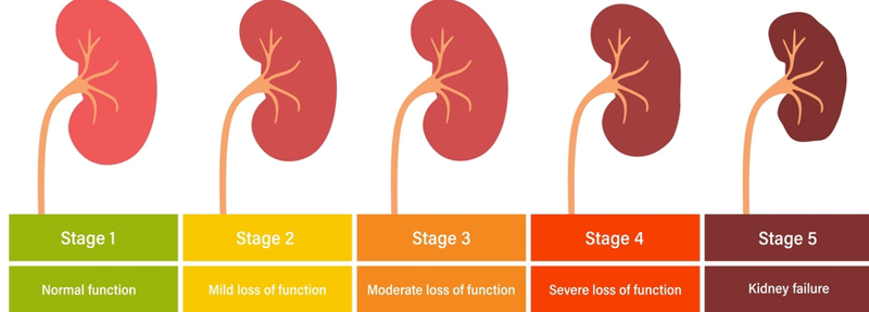 Staging of CKD