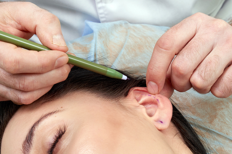 complications of ear correction surgery