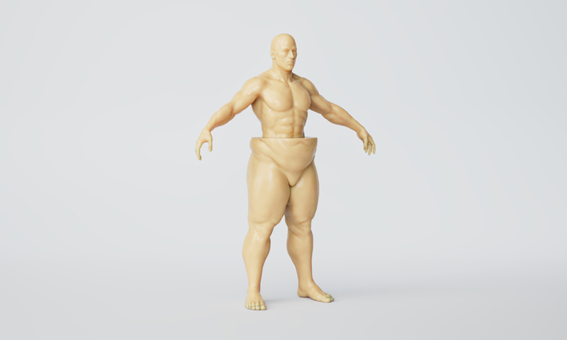 Body Liposuction Results