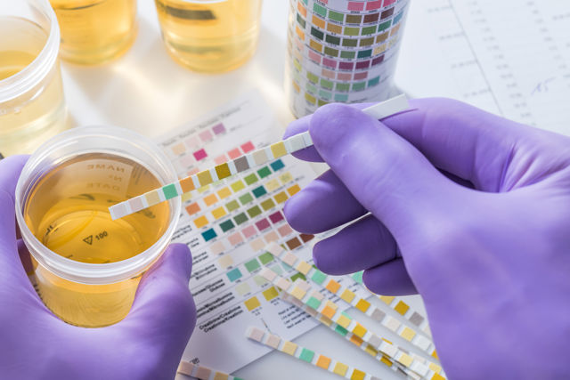 Types and Findings of Urine test