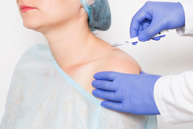 Преимущества артроскопической хирургии плеча