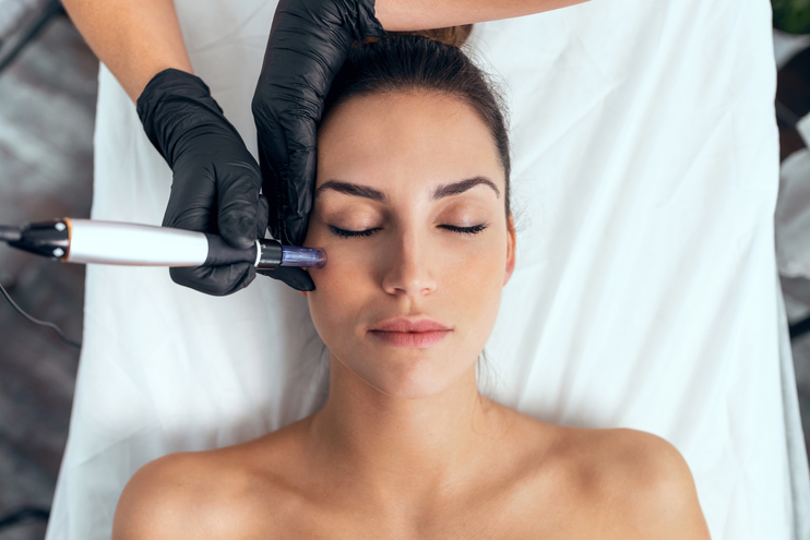 Fight Fine Lines with Microneedling