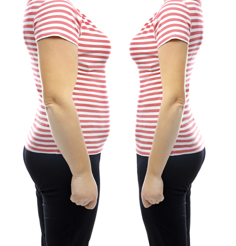 Body Liposuction vs Tummy Tuck