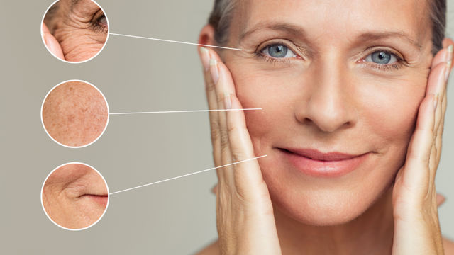 Facial Acupuncture Points