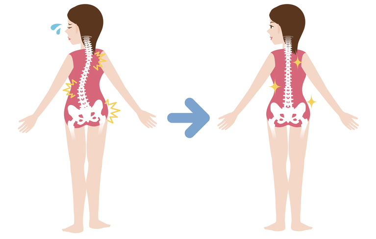 Scoliosis & Spinal Deformity