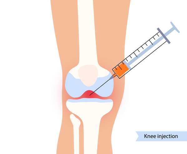 Knee Cartilage Repair