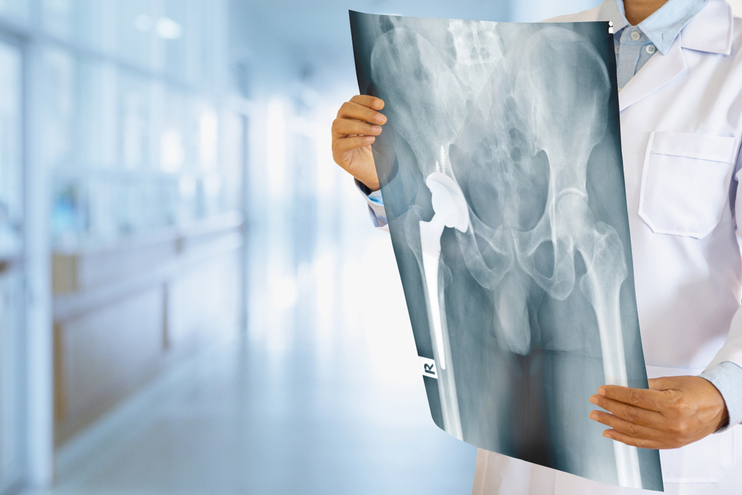 Partial Joint Replacement Preparation