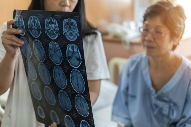 Diagnosis for Alzheimer's disease