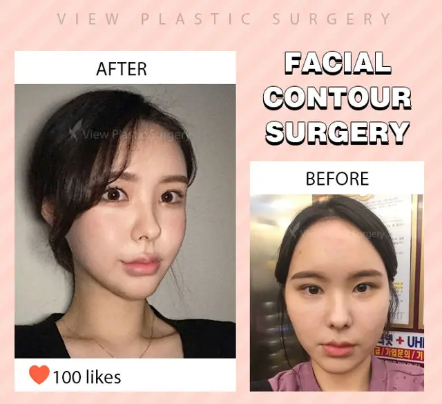 Frequently Asked Questions Facial Contour Most VIEWed FAQ