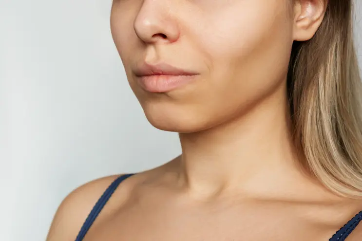 Buccal Fat Pad Excision