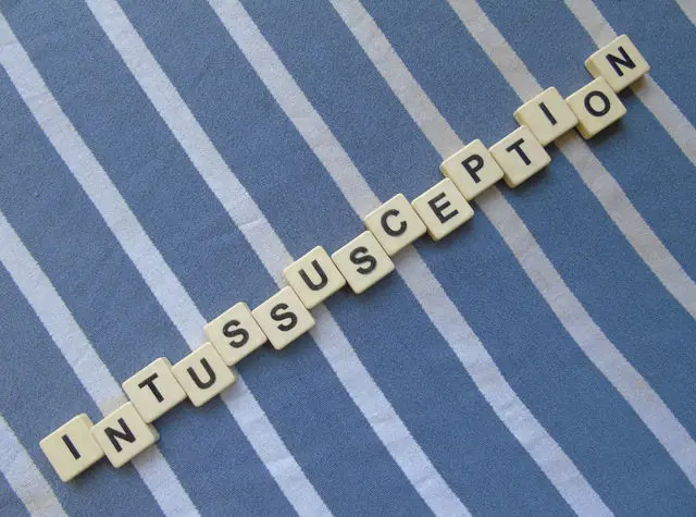 Intussusception Surgery