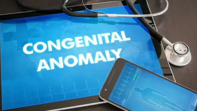Congenital anomaly