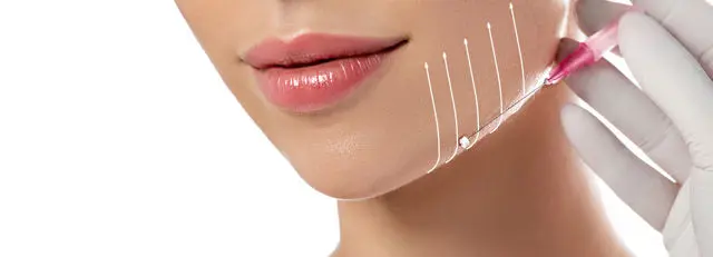 Thread lift