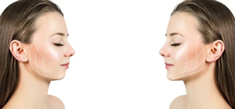 jaw-surgery-cost-by-countries