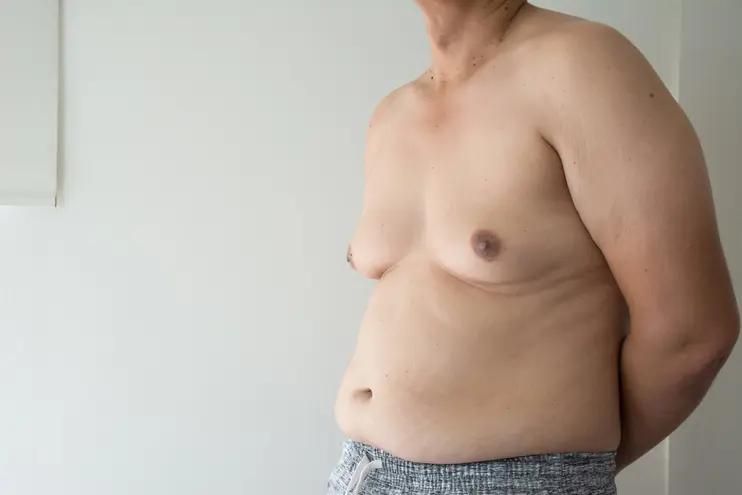 Gynecomastia Surgery 
