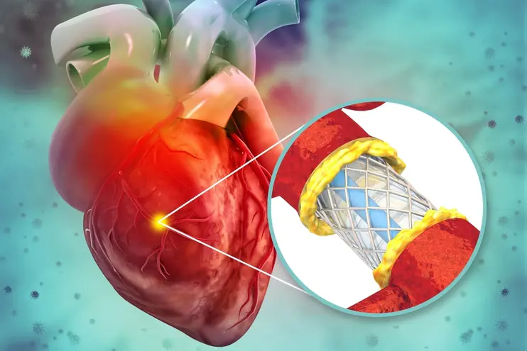 Advanced Invasive Cardiology Services