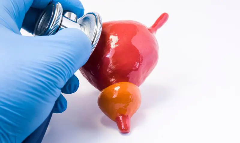 VUR (Vesicoureteral Reflux) Treatment