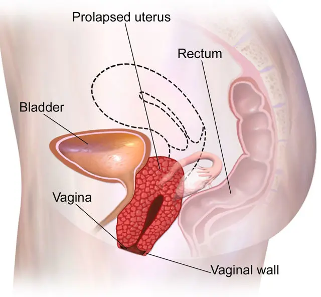 Arntgolts porno video