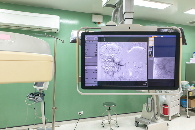 Minimally Invasive Interventional Radiology