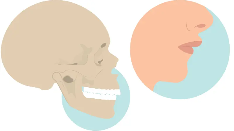 6 Ways to Design a Face Corrective Jaw Surgery to Optimize Bite, Airway,  and Facial Balance