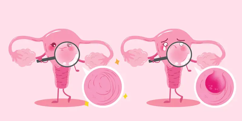 Ovarian Dysfunction Treatment