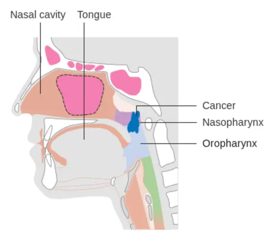 Nasopharyngeal Cancer Care