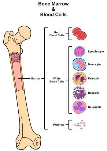 Pediatric Bone Marrow Transplant