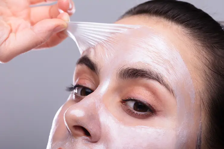 Chemical Peels
